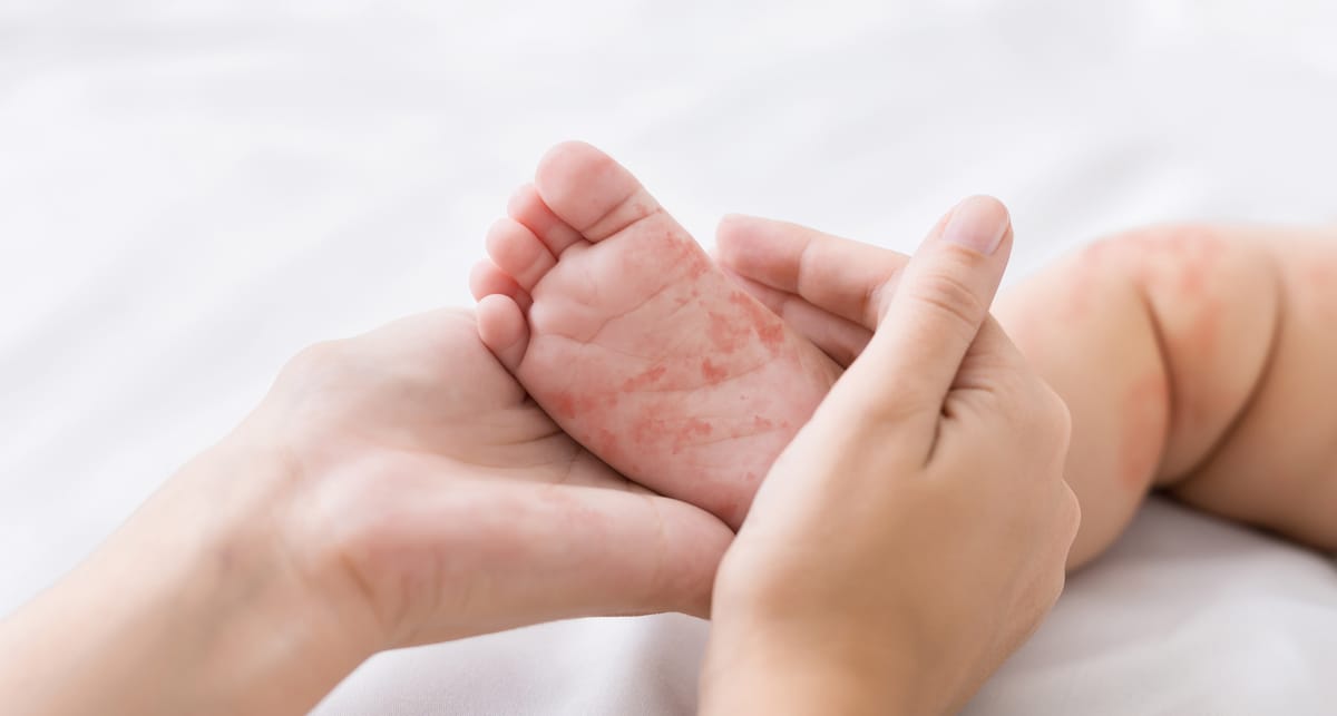 Dermatologia pediátrica