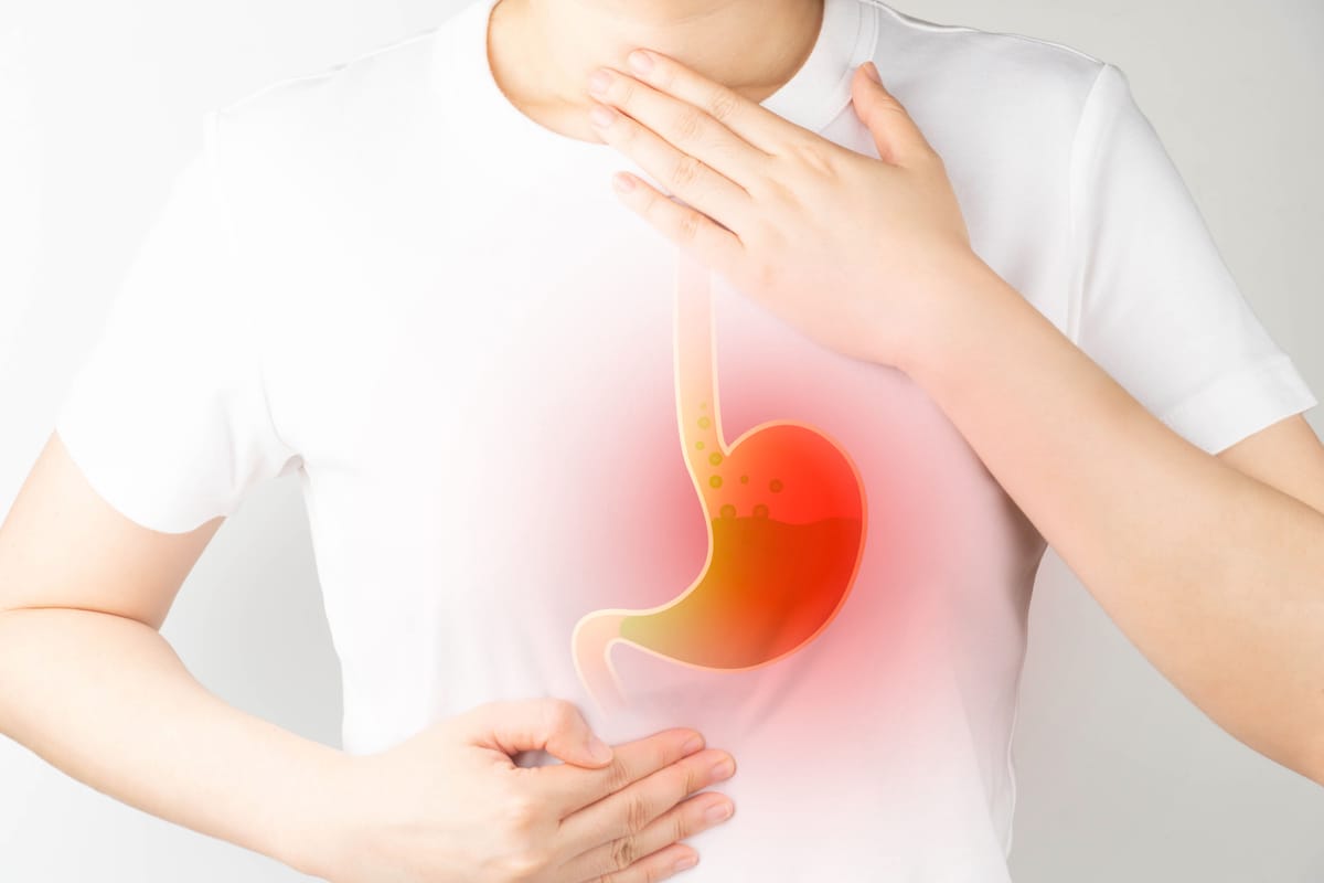 Cirurgia de Refluxo
