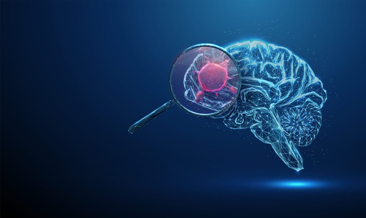 Tumores Cerebrais