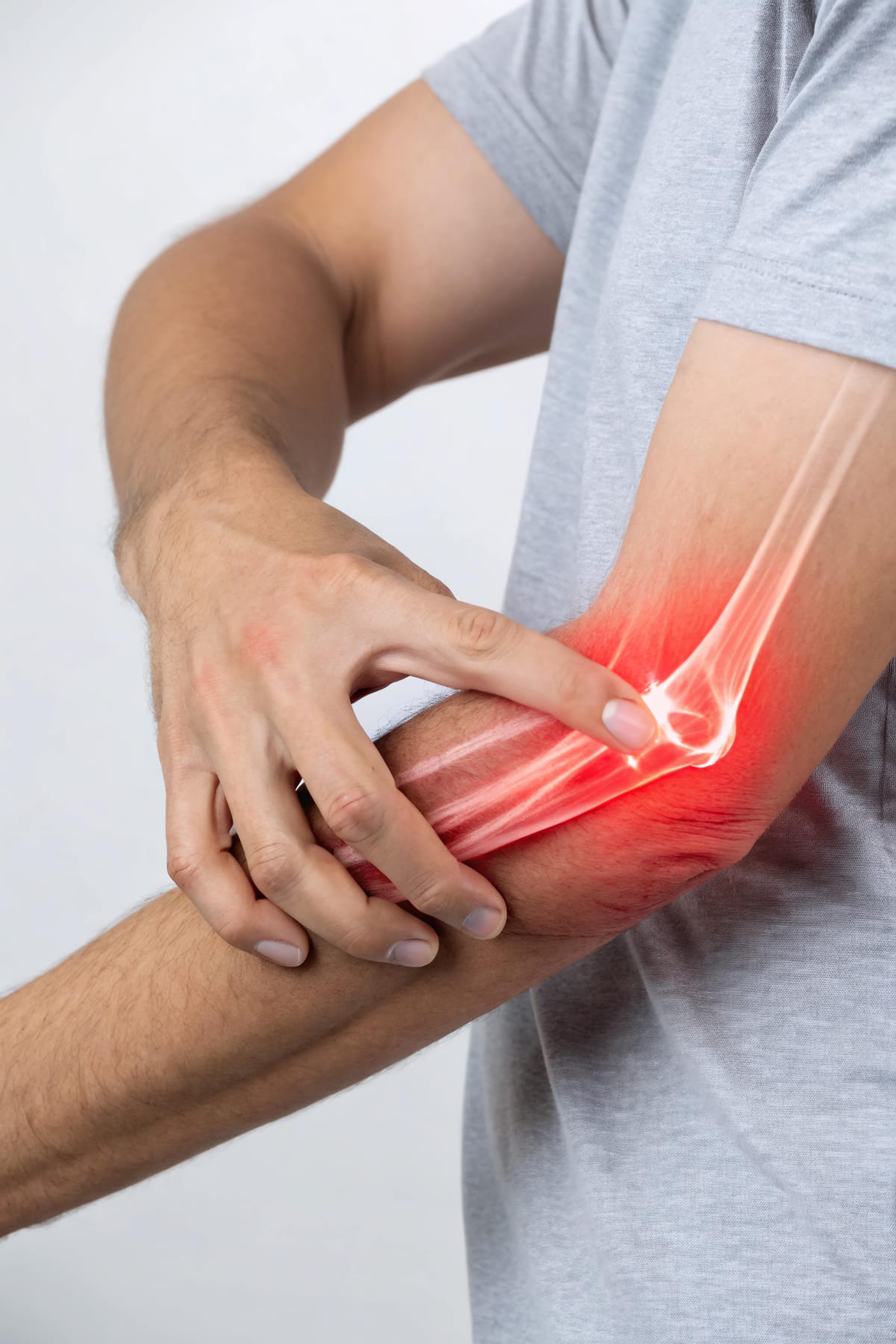 Epicondilite e tendinites do cotovelo