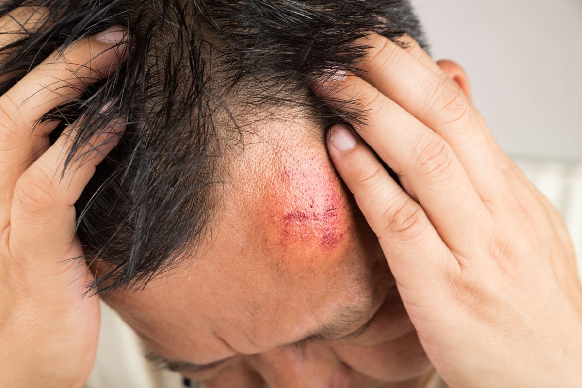Traumas Neurocirúrgicos e Suas Consequências