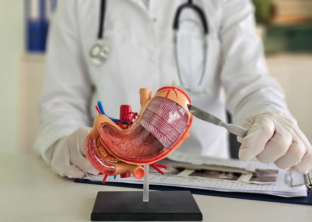 Gastrectomia Vertical (Sleeve Gástrico)