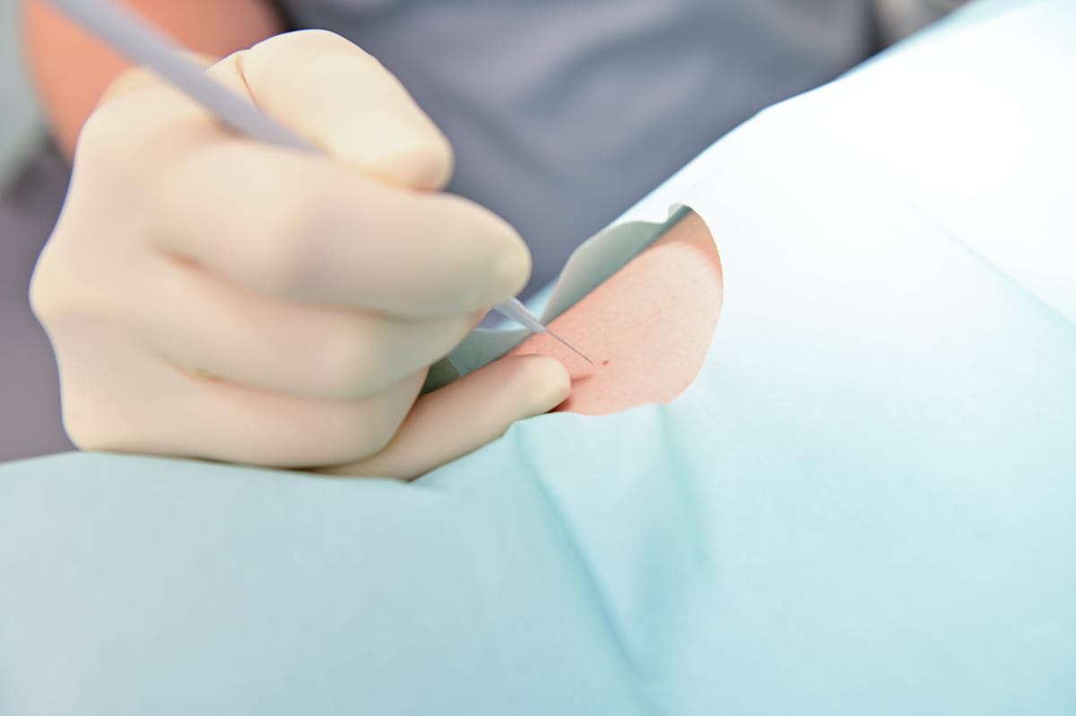 Dermatologia cirúrgica