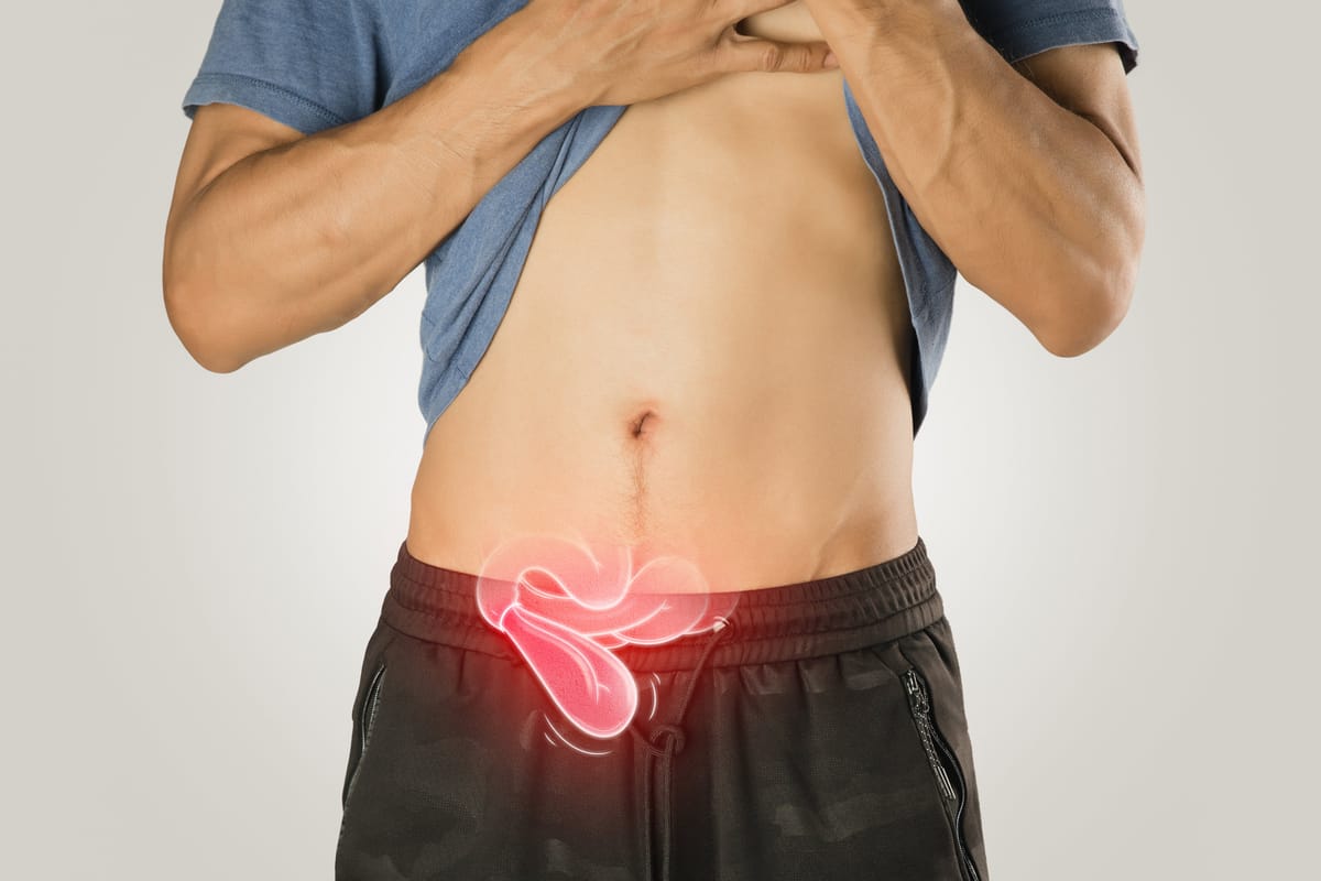 Hernia Inguinal por Videolaparoscopia