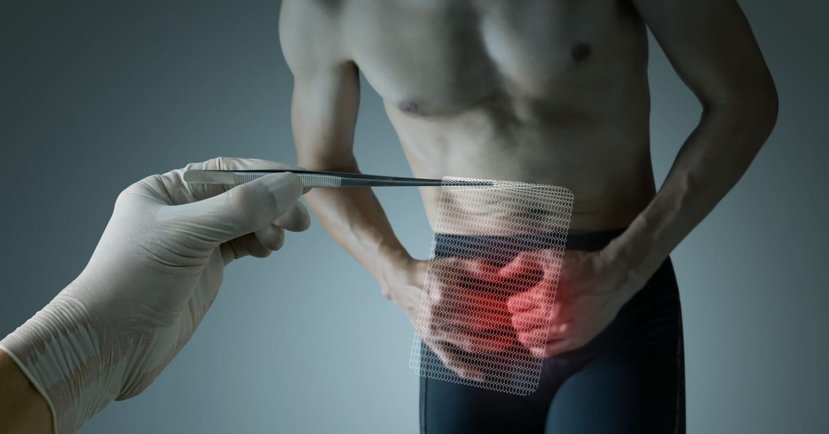 Hérnias da Parede Abdominal