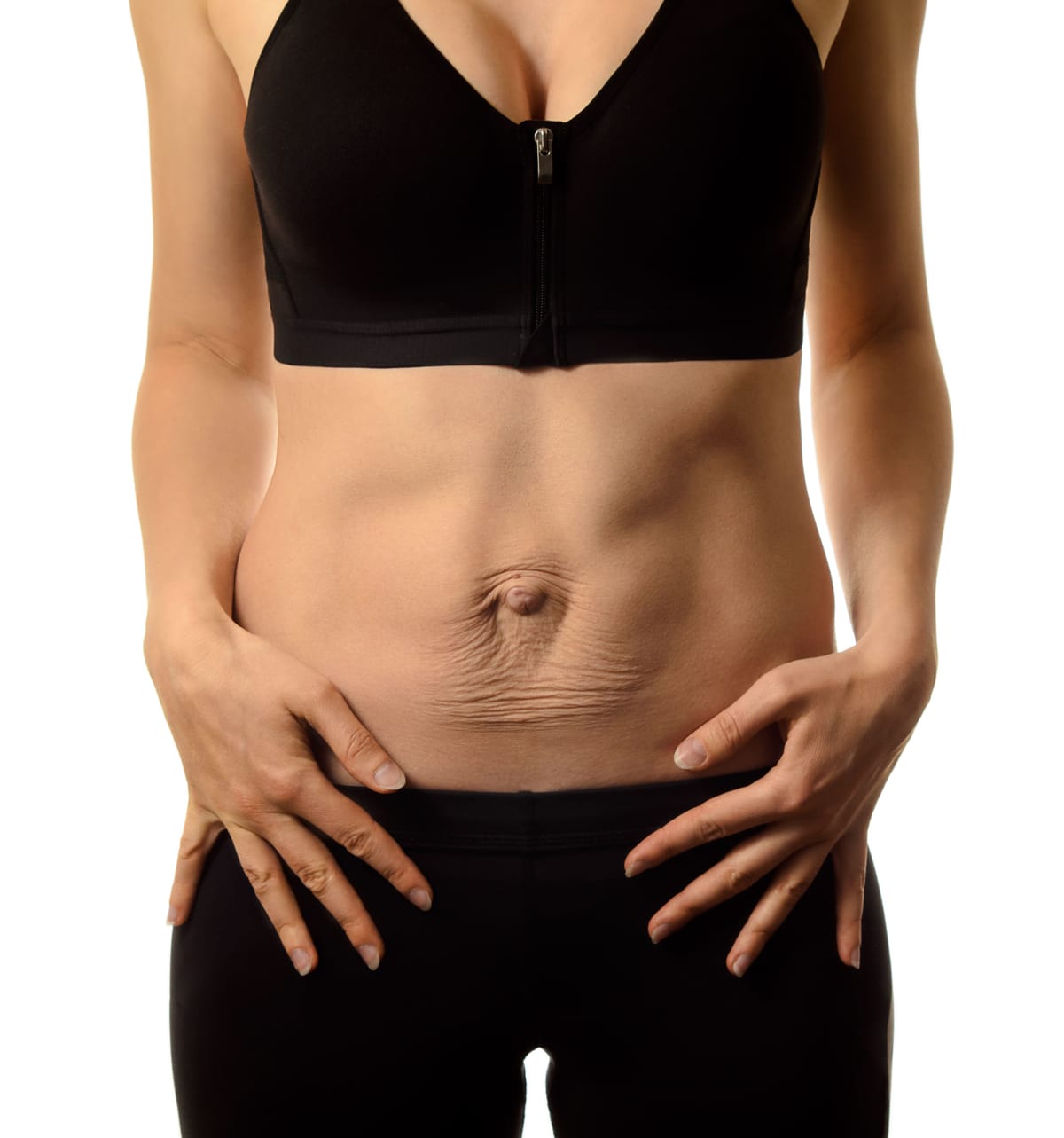 Cirurgia de Diástase de Reto